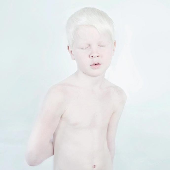 «Snow White» - серия портретов людей-альбиносов фламандского фотографа Sanne De Wilde